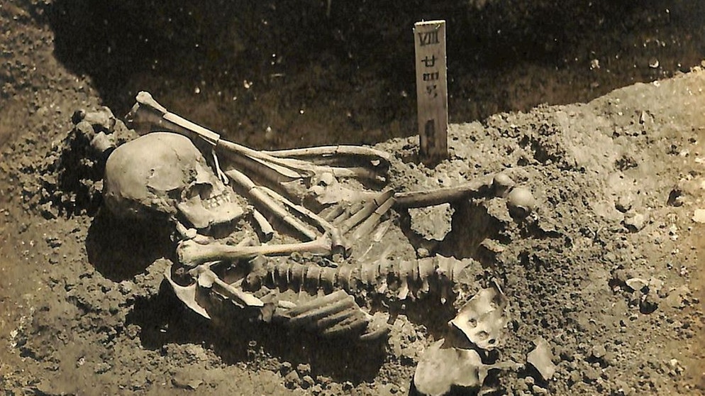 Das Bild zeigt das Skelett eines Menschen. Dieser Mensch wurde vor über 3.000 Jahren Opfer eines Haiangriffs. Mindestens 790 tiefe Wunden weist sein Skelett auf, hauptsächlich an Armen, Beinen, an der Brust und am Bauch. Die linke Hand fehlt, das rechte Bein auch. Forscherinnen und Forscher rekonstruierten den wahrscheinlichen Hergang aufgrund der Verletzungen: Demnach handelt es sich dabei um einen Mann, der vor rund 3.000 Jahren im Seto-Innenmeer von Japan von einem Hai angegriffen wurde. Vielleicht war er zusammen mit weiteren Fischern dort unterwegs, da sein Körper offensichtlich schnell geborgen und in einem Gemeinschaftsgrab begraben werden konnte. Damit ist er das bislang älteste Opfer einer Haiattacke, den Archäologinnen und Archäologen bislang kennen. | Bild: Kyoto University