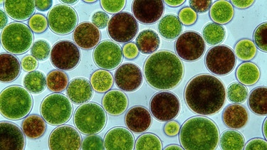 Die Alge Haematococcus unter dem Mikroskop | Bild: picture-alliance/dpa
